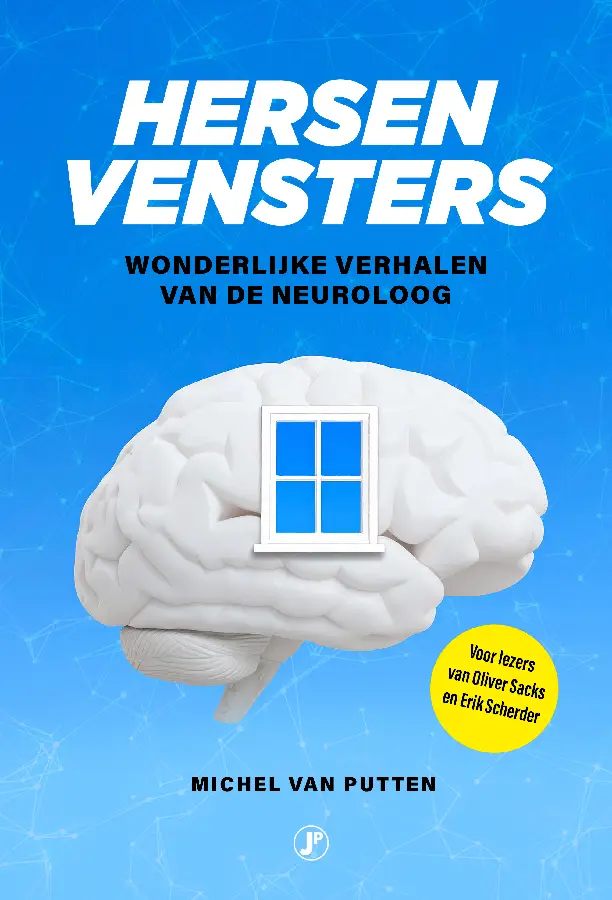 Hersenvensters