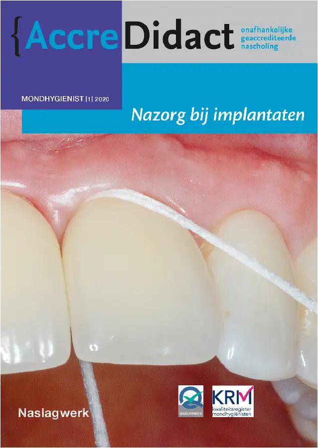 Nazorg bij implantaten / Mondhygiënist 2020-1